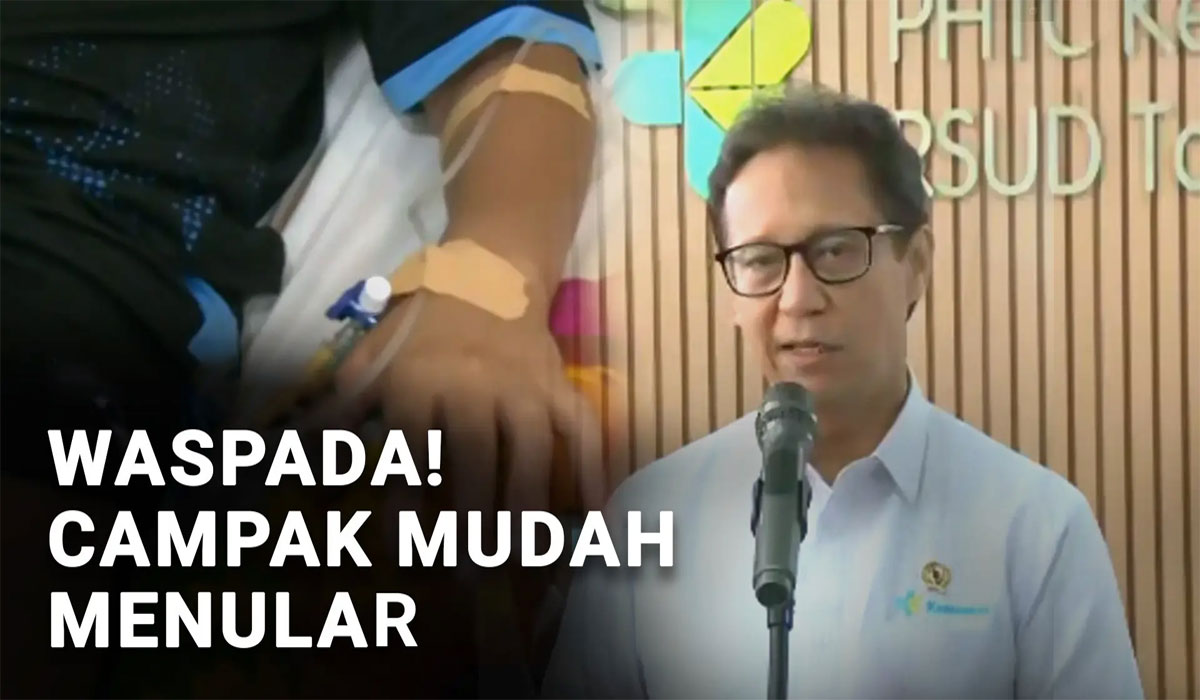 Breaking! Dokter Meninggal karena Suspek Campak, Kemenkes Bergerak Cepat Lakukan PE!